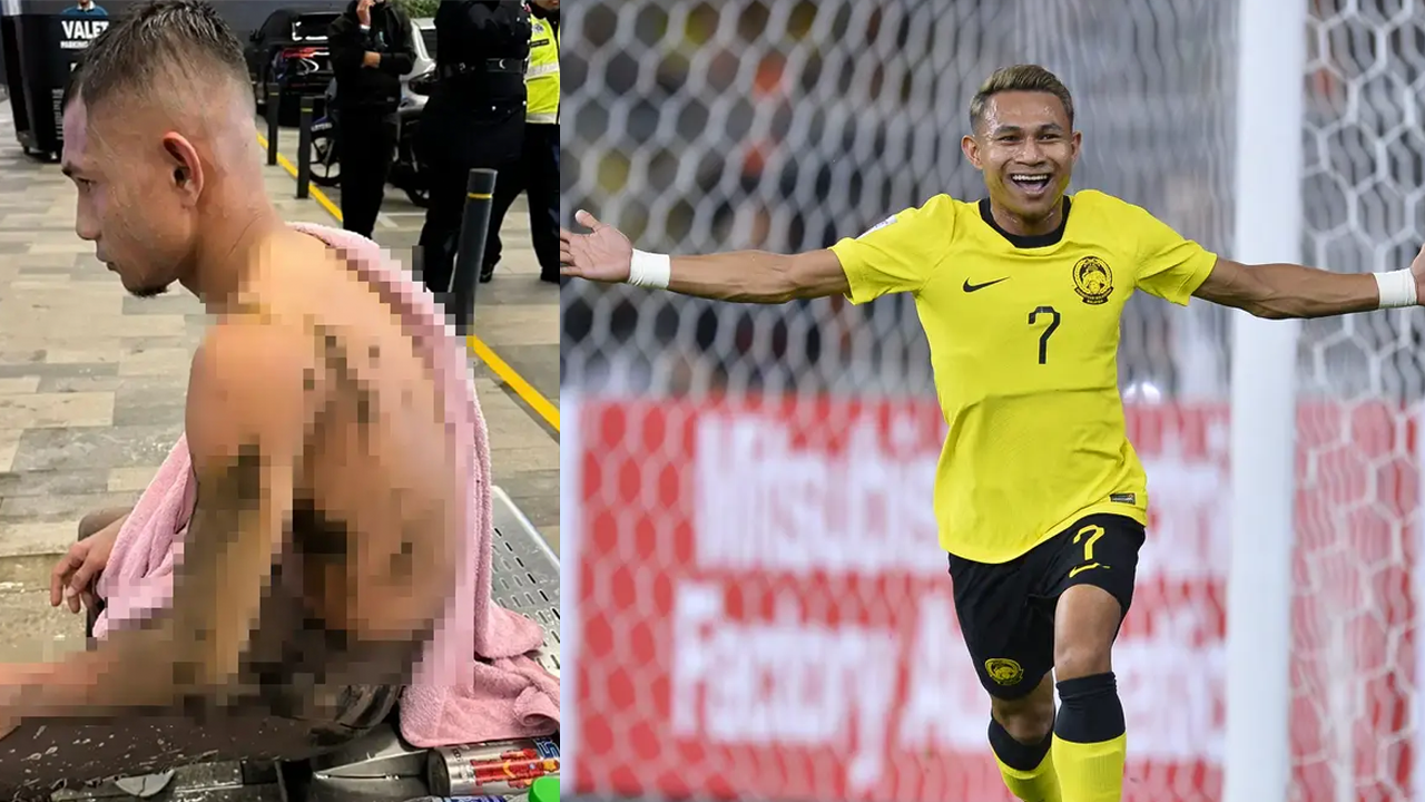 Tuyển thủ Malaysia rên rỉ trong đau đớn, đối diện nguy cơ giải nghệ sau vụ tạt a xít