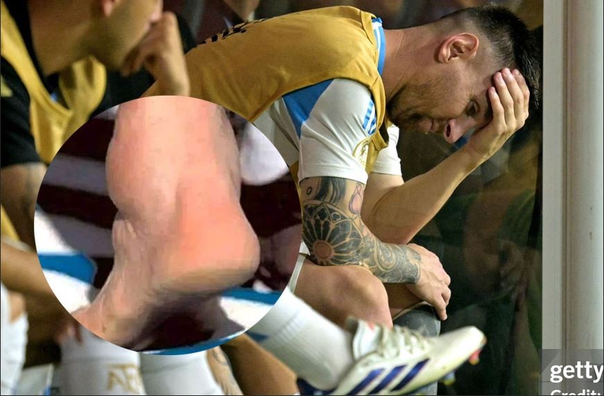 Messi bật khóc nức nở rời sân sớm, Aghentina vẫn vô địch thuyết phục