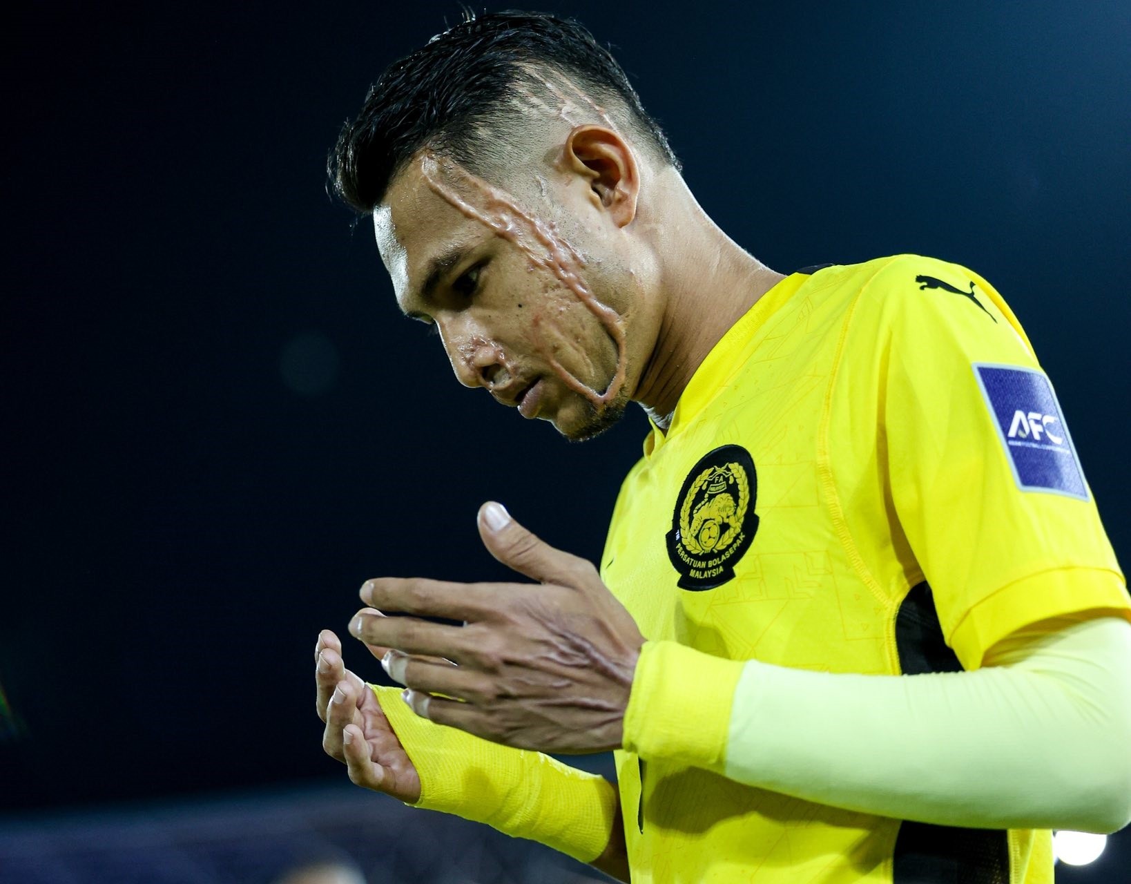 Cầu thủ Malaysia trở lại sau biến cố kinh hoàng, sẵn sàng đấu tuyển Việt Nam