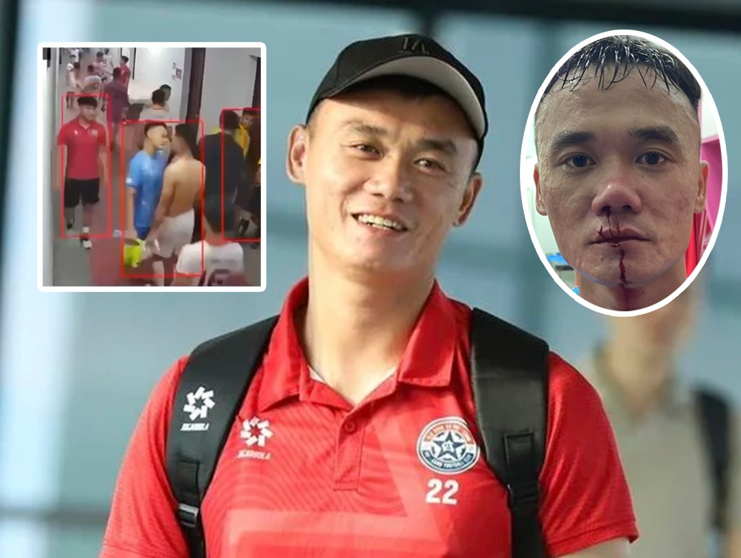 CLB PVF-CAND lên tiếng: "Xuân Nam không đấm trước"